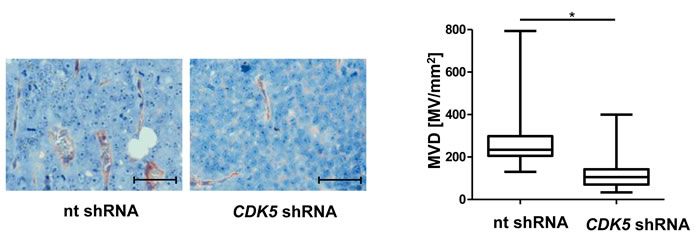 Knockdown of CDK5 in HUH7 cells reduces vascular density in HCC xenografts.