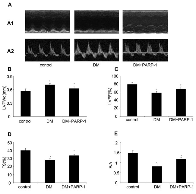 PARP-1 inhibition improved hyperglycemia-reduced cardiac function.