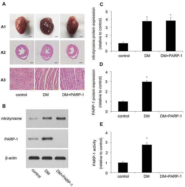 Myocardial pathology feature and PARP-1 expression in mice.