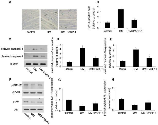 PARP-1 deletion reduced hyperglycemia-induced cardiomyocyte apoptosis.