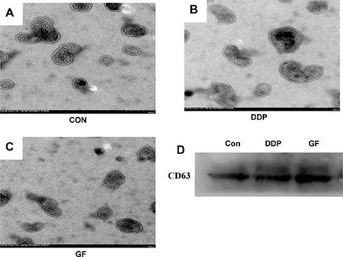Characterization of exosomes isolated from supernatant samples.