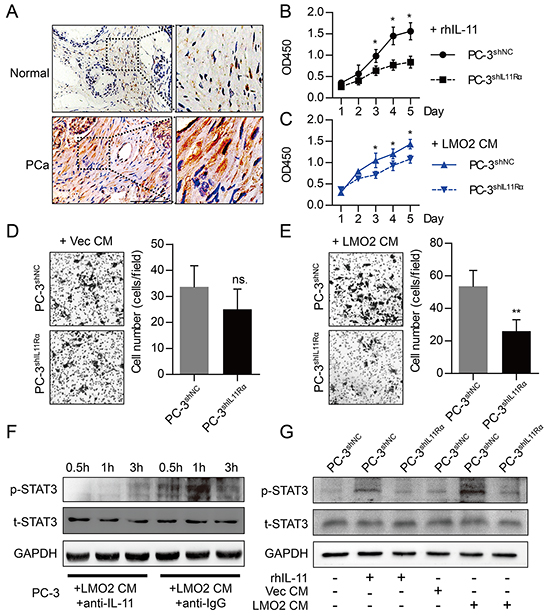Paracrine of IL-11 by prostate stromal cells promotes proliferation and invasiveness of PCa cells via activating STAT3 signaling.