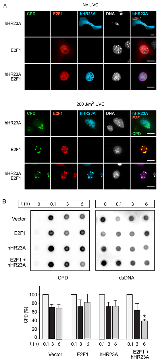 Increased repair of UV-induced DNA damage by E2F1 and hHR23A.