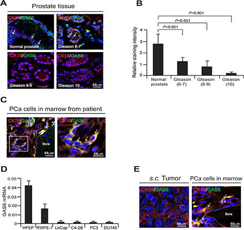 Bone marrow microenvironment activates endogenous GAS6 expression in PCa cells.