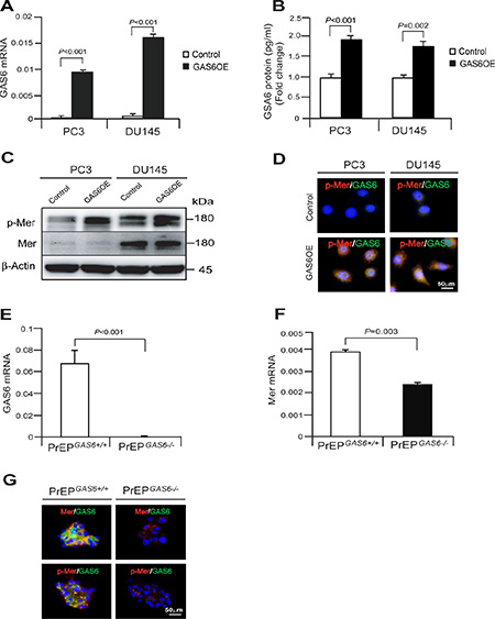 GAS6 overexpression activates the phosphorylation of Mer signaling in prostate epithelial cells or cancer cells. (A)