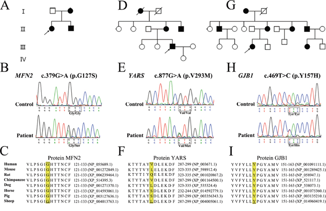 Pedigree, sequencing chromatograms and conservation analysis of novel variants detected by targeted NGS.