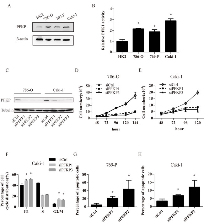 PFKP knockdown leads to impaired cell proliferation, cell cycle arrest and apoptosis in kidney cancer cell lines.