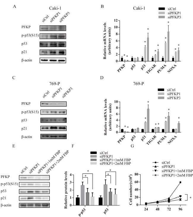 FBP deficiency due to PFKP suppression activates the p53 pathway in kidney cancer cells.