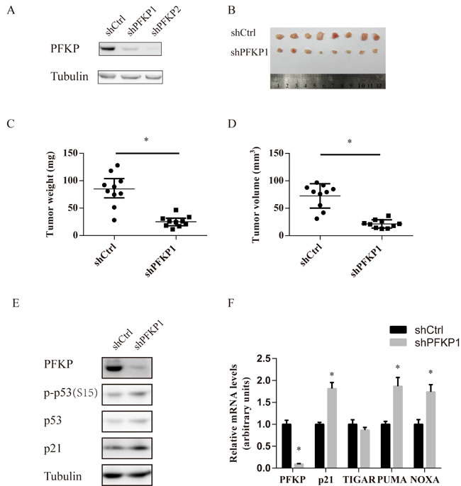 PFKP suppression inhibits renal xenograft tumor growth.