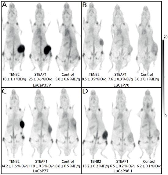 Maximum intensity projections from mouse coronal views of 89Zr-immunoPET images obtained 5 days post injection of TENB2, STEAP1 and control (gD) mAbs in four LuCaP tumor types:
