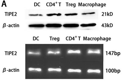 TIPE2 expressions in DCs from BALB/C mice (