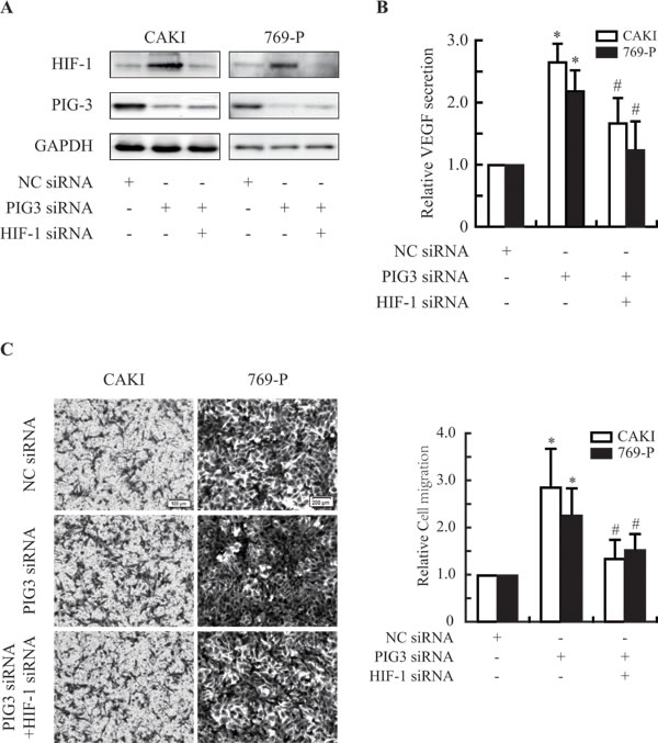 PIG3-silencing promotes the secretion of VEGF and the migration of CAKI and 769-P cells.