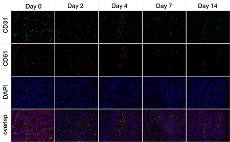 Immunofluorescence staining of tumor vasculature and murine integrin &#x03B1;v&#x03B2;3 expression with antibodies against CD31 (green) and CD61 (integrin &#x03B2;3, red) in the Endostar treatment group at different time point.