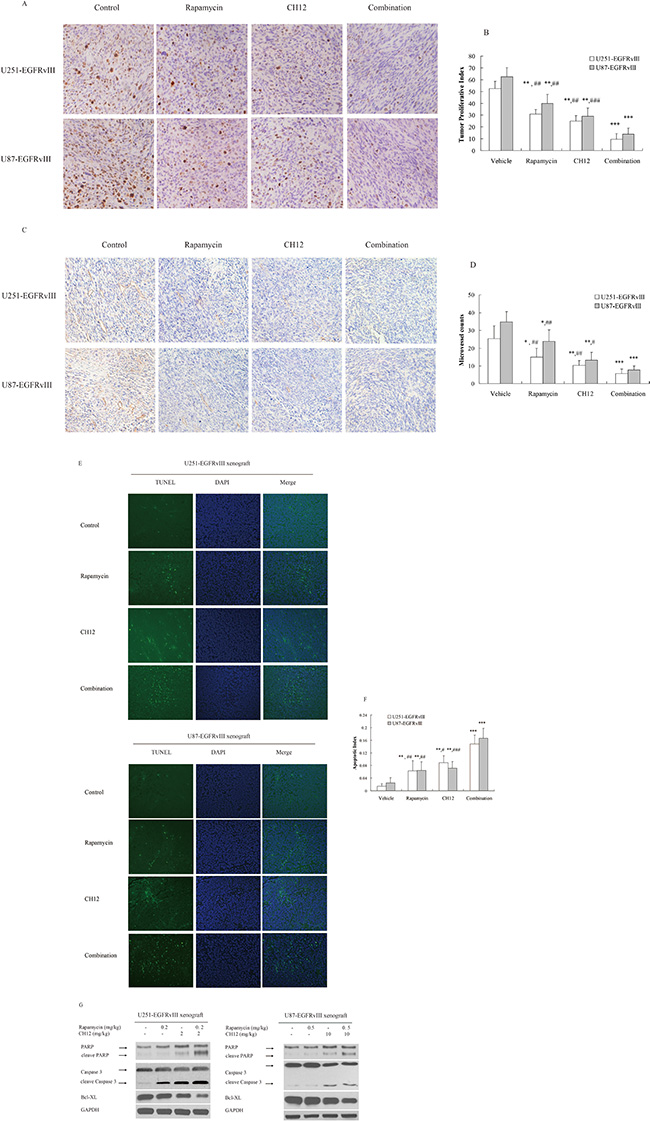 Combination of CH12 with rapamycin reduced proliferation and angiogenesis and induced tumor cell apoptosis.