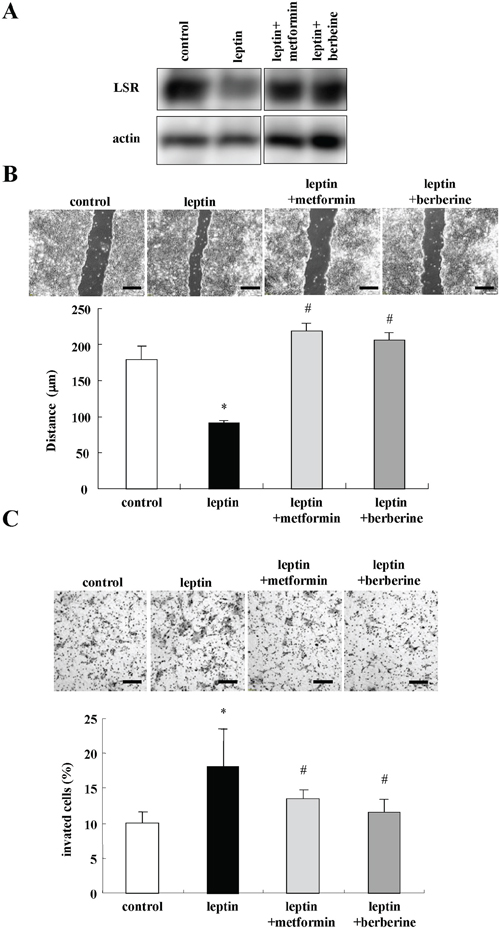 Metformin and berberine inhibit cell migration and invasion induced by leptin in Sawano cells.