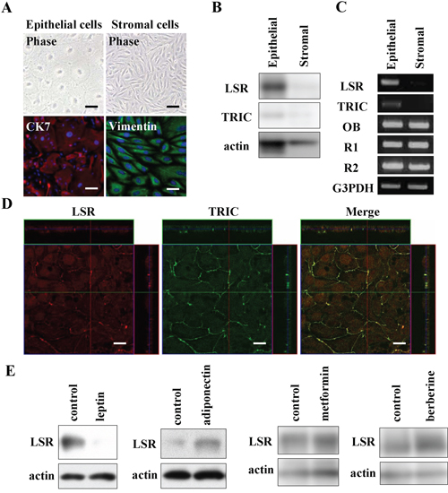 Expression and localization of LSR and TRIC in human endometrial epithelial (HEE) cells and the changes of LSR by leptin, adiponectin, metformin, and berberine.
