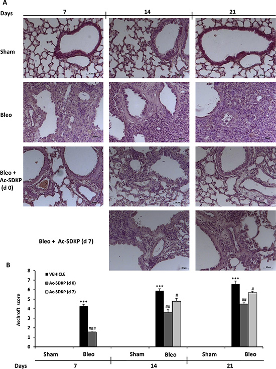 Ac-SDKP treatment suppressed BLEO-induced histological marks of lung damage and fibrosis in mouse lung.