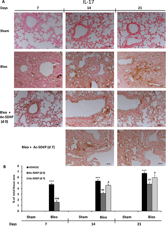 Ac-SDKP treatment inhibited BLEO-induced IL-17 expression in mouse lung tissue.