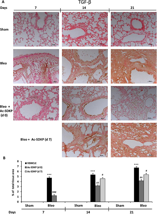 Ac-SDKP treatment inhibited BLEO-induced TGF-&#x03B2; expression in mouse lung tissue.
