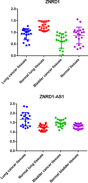 Quantification and statistical analysis of ZNRD1-AS1 and ZNRD1 expression in bladder cancer and matched normal tissues
