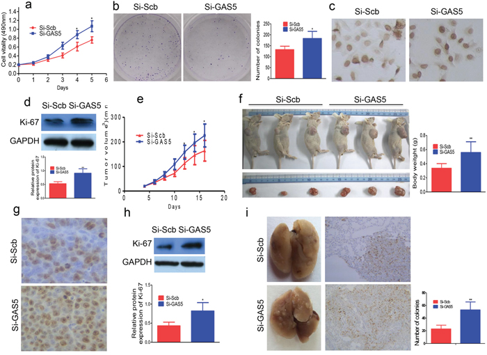 GAS5 knockdown promotes breast cancer cell proliferation.