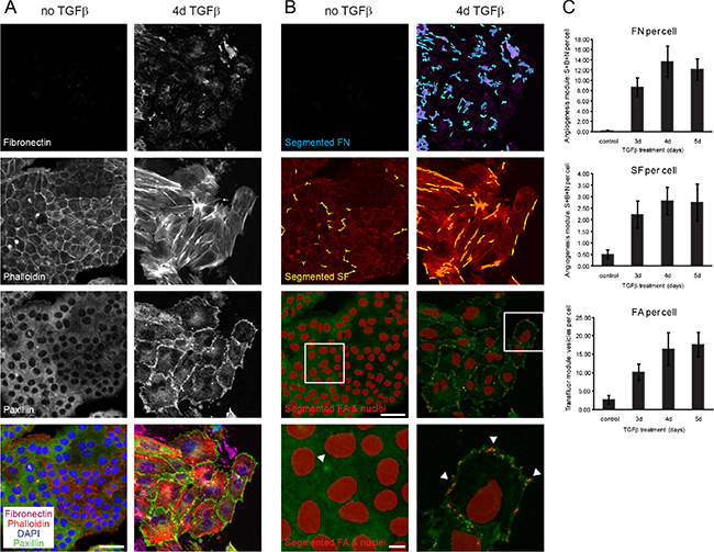 Segmentation and quantification of focal adhesions, actin stress fibers and fibronectin deposition as EMT readouts.