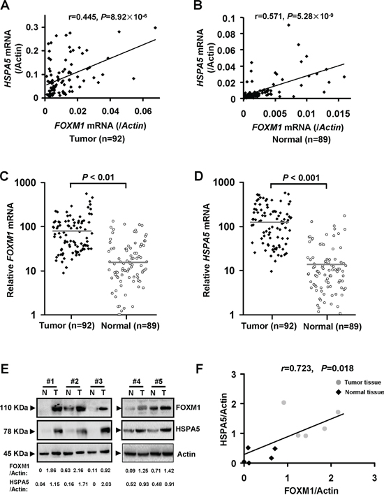 FOXM1 mRNA expression is elevated in most colorectal cancer tissues and positively correlated with HSPA5.