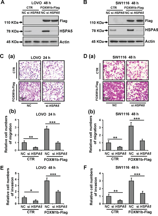 Depletion of HSPA5 attenuates cell migration and invasion induced by FOXM1.
