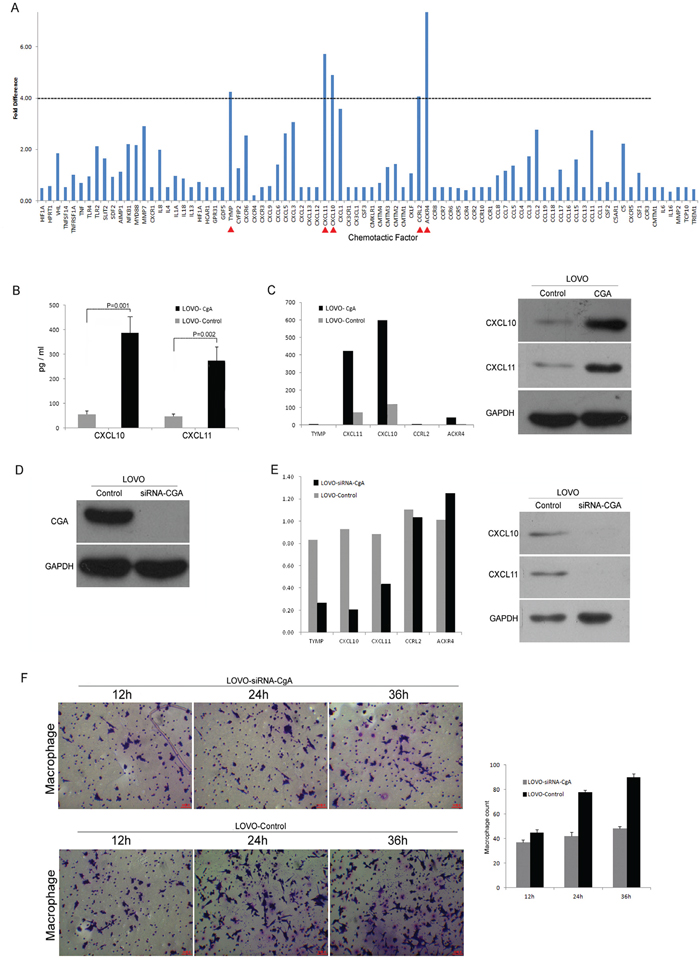 Neuroendocrine-like cells promote the chemotaxis activity of TAM via CXCL10 and CXCL11.