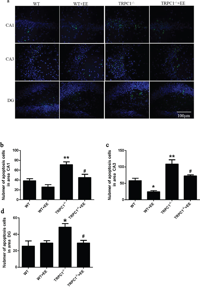 TRPC1 depletion caused hippocampal neuronal apoptosis.