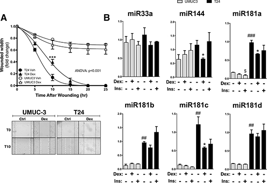 The effect of dexamethasone treatment on cell migration and miRNA expression in UMUC-3 and T24 bladder cancer cells.