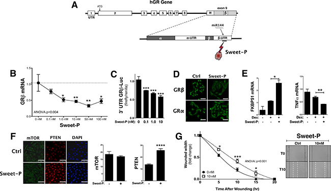 Blocking the miR144 binding site in the 3&#x2032;UTR of human GR&#x03B2; by Sweet-P inhibits expression and cell migration.
