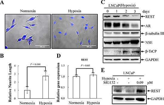 Hypoxia induces NED of LNCaP cells concomitant with down-regulation REST protein levels but not REST mRNA.