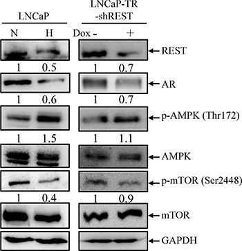 AMPK/mTOR pathway is activated by hypoxia treatment and REST knockdown.