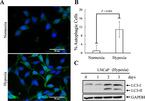 Hypoxia-induced autophagy activation of LNCaP cells.
