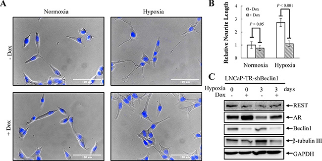 Knockdown of beclin 1 suppresses hypoxia-induced NED.