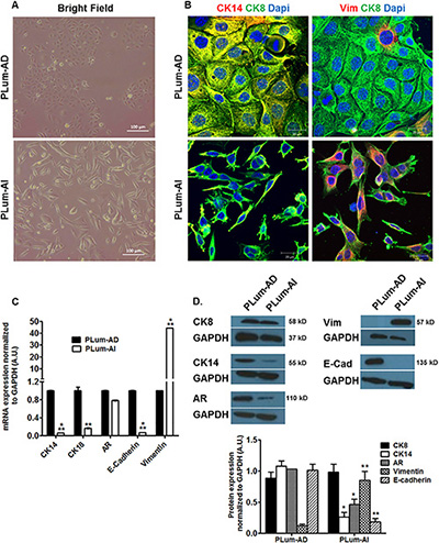 Lineage characterizations of PLum-AD and PLum-AI cell lines.