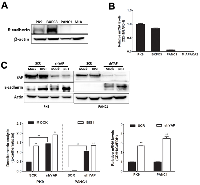 BIS I reverts YAP-induced EMT in PDAC cell lines.