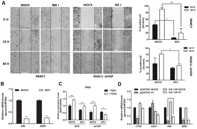 Genetic ablation of YAP and BIS I treatment regulate cell migration.