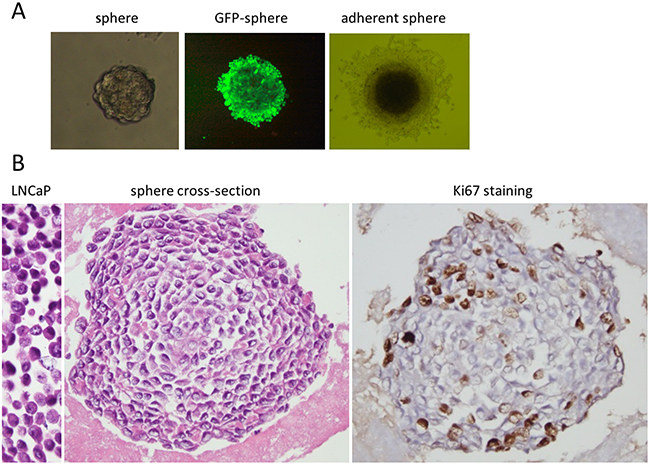 Structure of LNCaP prostate cancer spheres.