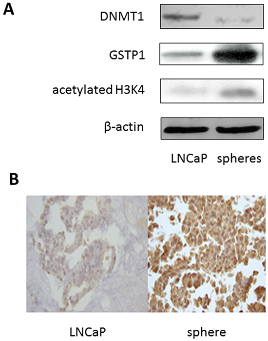 Epigenetic marks of LNCaP sphere cells.