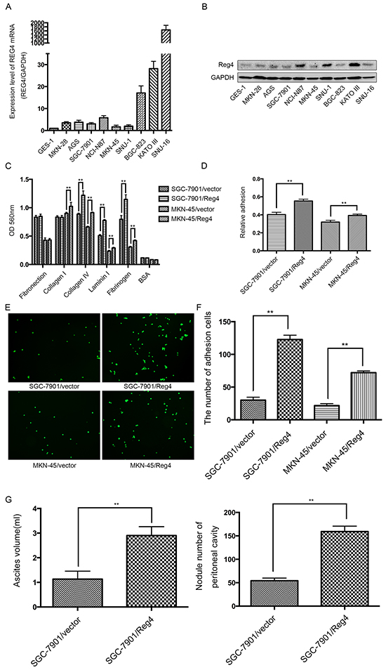 REG4 promotes adhesion and peritoneal metastasis of gastric cancer cells.