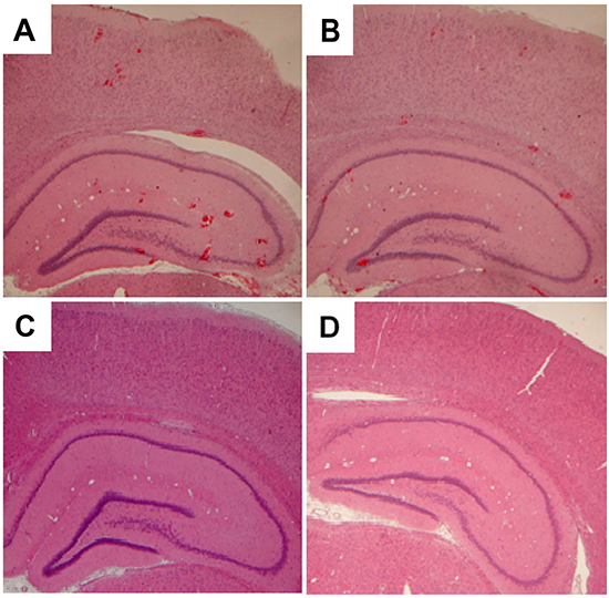 Observations of the brains with sonication by hematoxylin-eosin-stained sections.