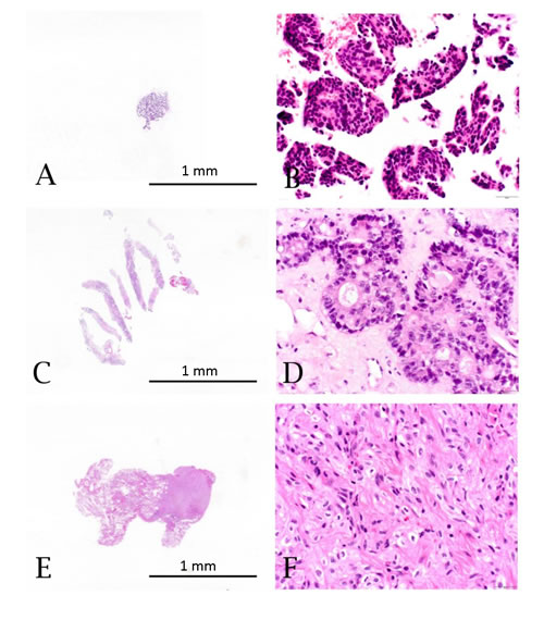 Hematoxylin and eosin stained specimens from limited tissue sample types: