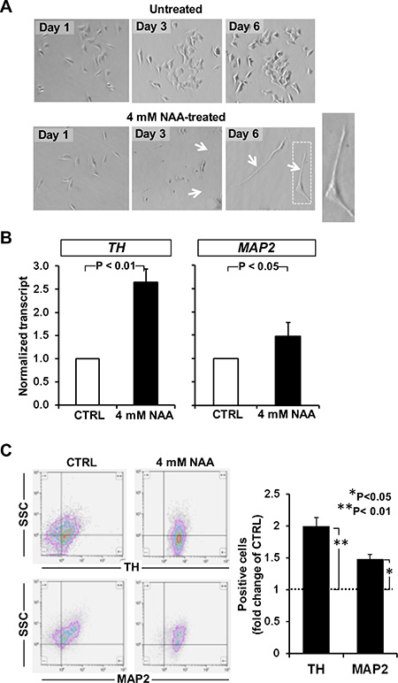 Effect of NAA on cell morphology and neuronal marker expression.