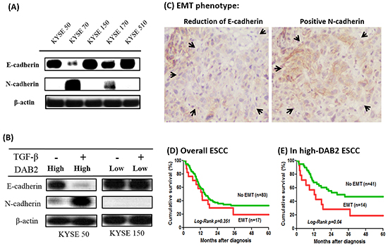 The high-DAB2 esophageal cancer cell had the presence of epithelial-mesenchymal transition (EMT).