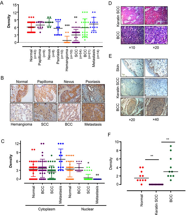 IKK&#x3b1; was dysregulated and delocalized in skin-related tumors.