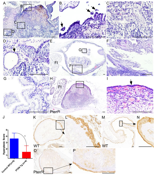 Overexpression of Pten inhibits ovarian surface epithelial hyperplasia in aged ovaries.