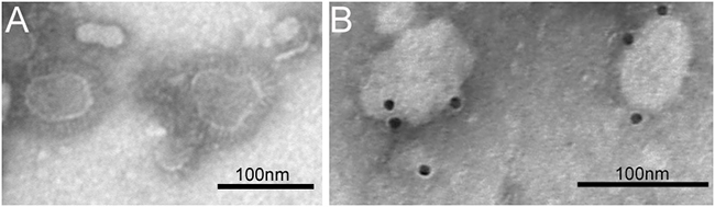 TEM and IEM analysis of MERS-CoV VLPs.
