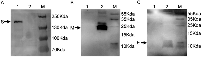 Detection of expression of S, E and M proteins in MERS-CoV VLPs.